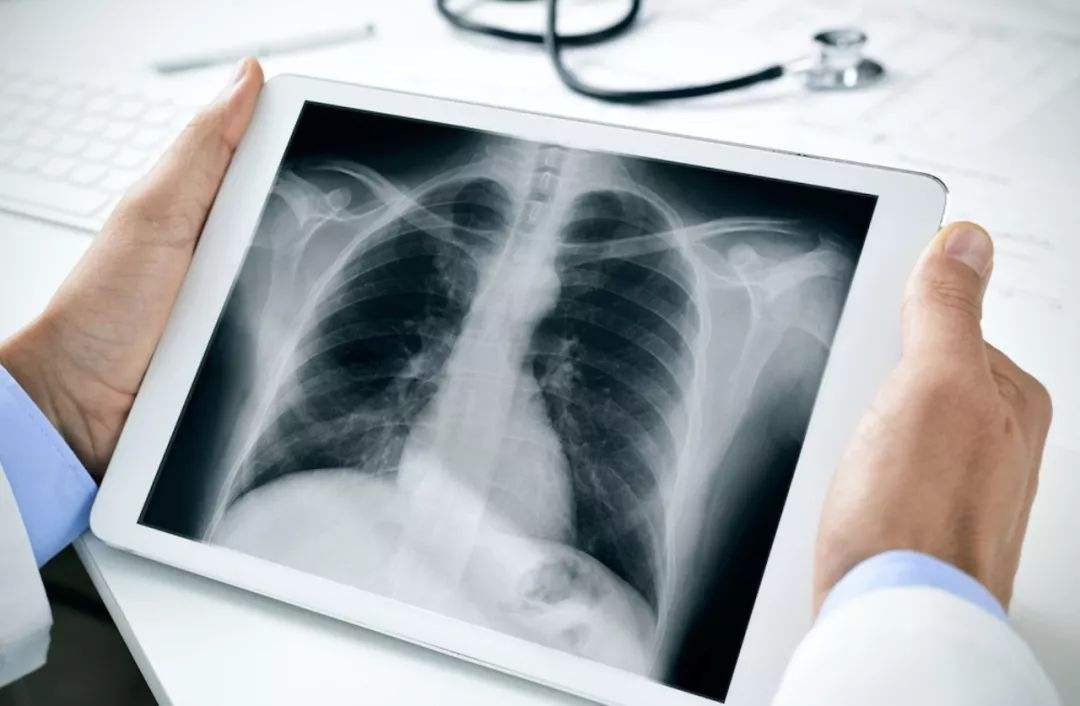 <a href='https://www.haoeyou.com/lungcancer/' target='_blank'><u>肺癌</u></a>15.jpg