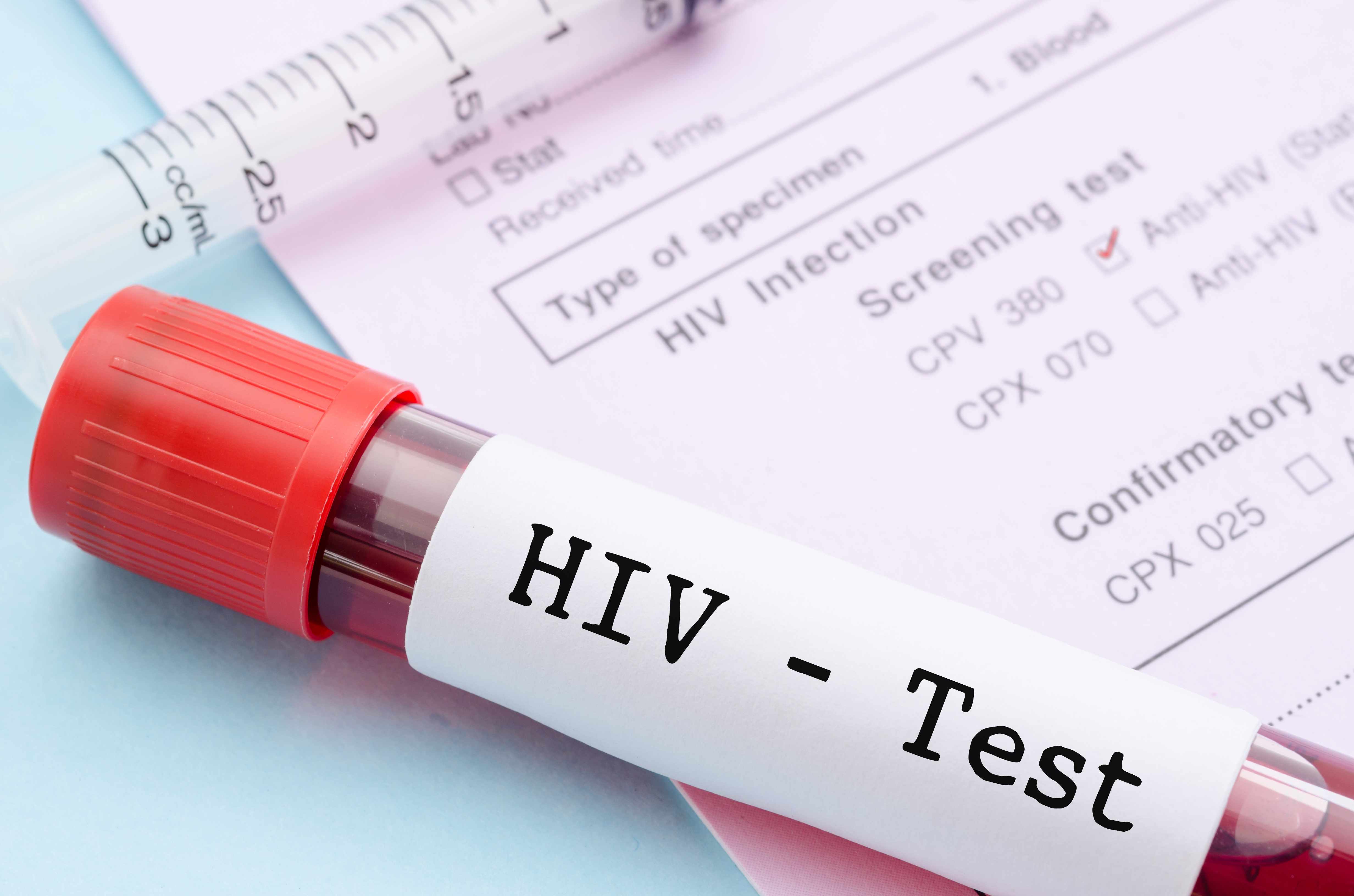 HIV (9).jpg