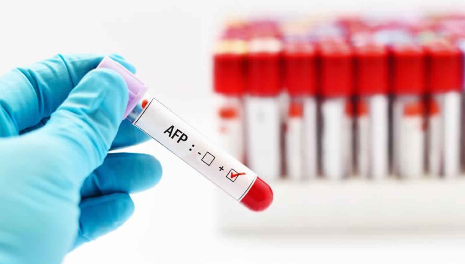 alpha-fetoprotein.jpg