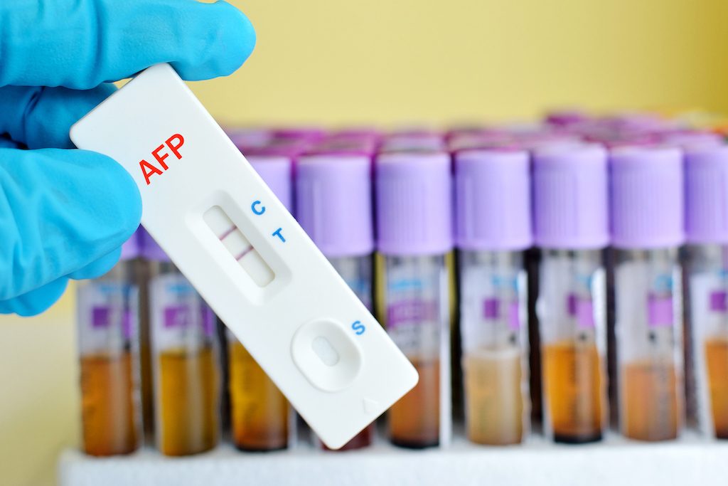 肝检查AFP (1).jpg