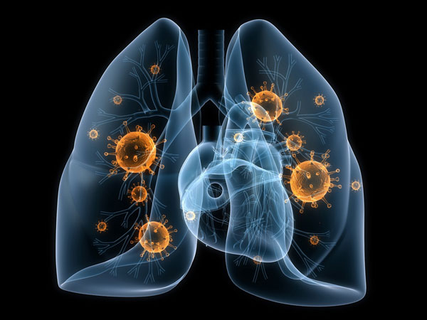 Lungs-with-bacteria-low-res.jpg