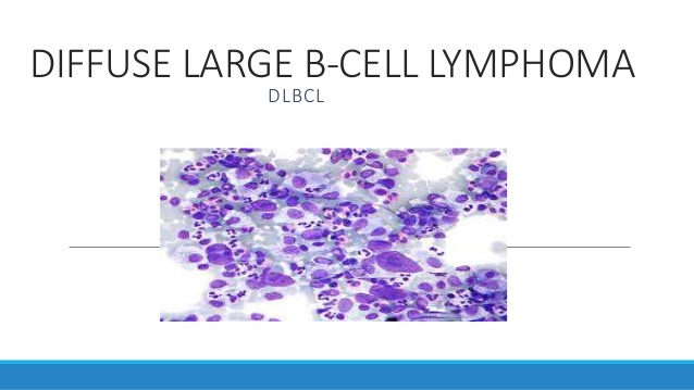 dlbcl-1-638.jpg
