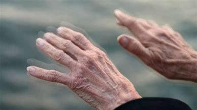 帕金森 (8).jpg