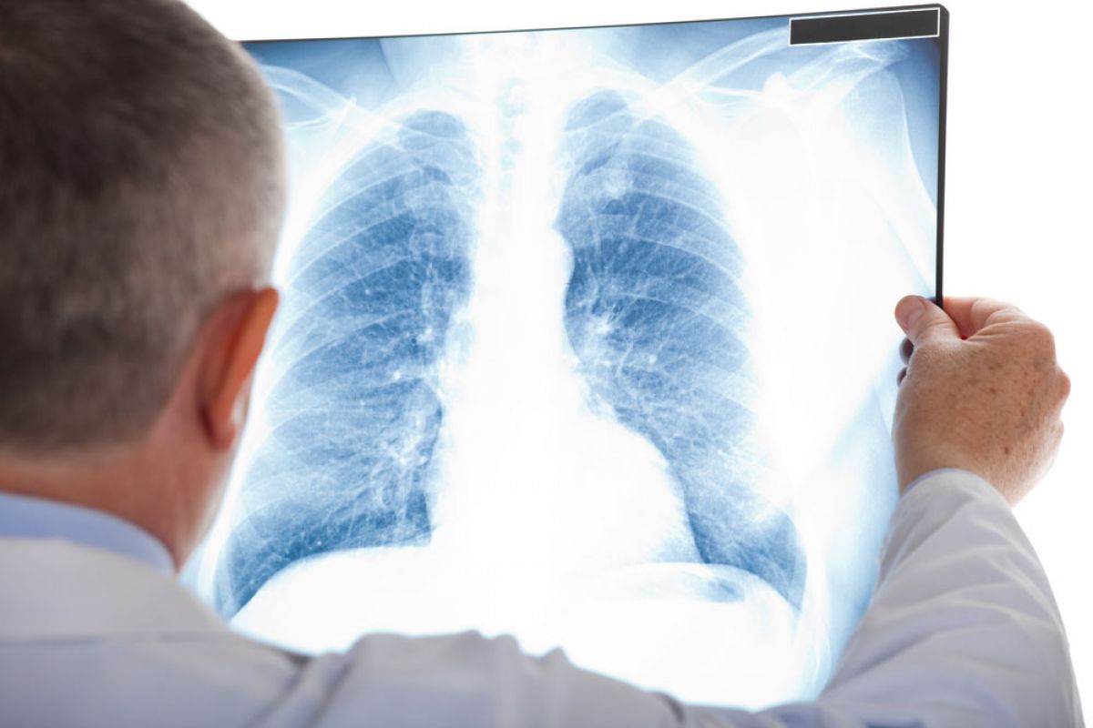 <a href='https://www.haoeyou.com/lungcancer/' target='_blank'><u>肺癌</u></a> (19).jpg