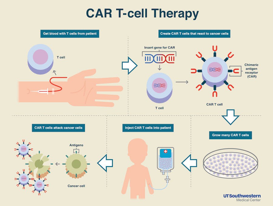CAR-T1.jpg