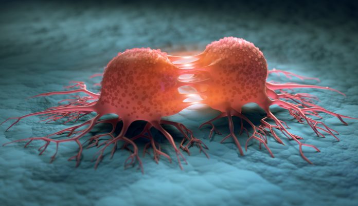 TumorCells-1180568434-696x402.jpg