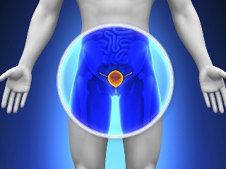 <a href='https://www.haoeyou.com/prostaticcancer/' target='_blank'><u>前列腺癌</u></a> (7).jpg