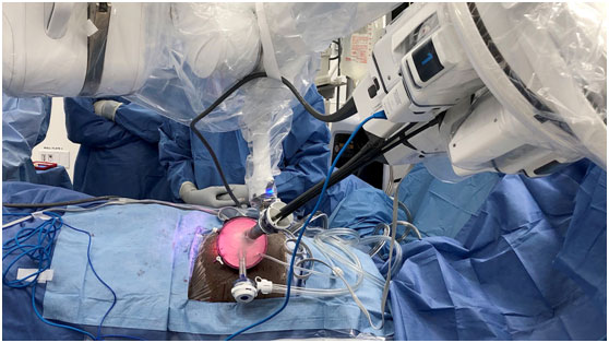 她，成为世界首个接受“单端口机器人”肾移植术的人，术后两天即出院