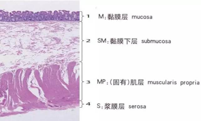 肠壁分层5层示意图图片