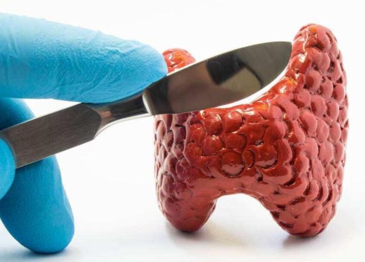 甲状腺癌手术.jpg